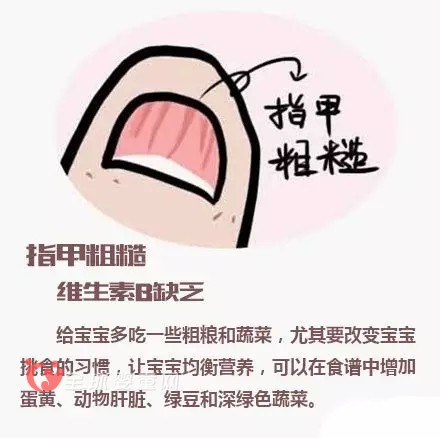 宝宝指甲透露出来的健康问题 爸爸妈妈注意到了吗？