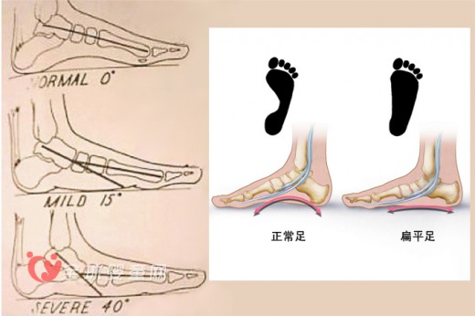 童鞋设计要符合孩子生长发育特点