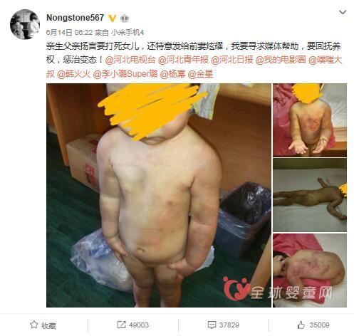 疯狂虐童只为报复前妻   虐待儿童可判刑吗