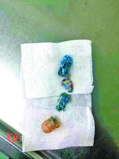 2岁女童拿什么吃什么 结果胃中出现奶嘴和碎硬纸屑
