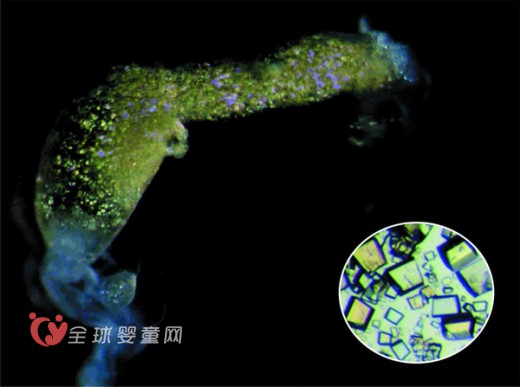 “蟑螂奶”是否成为人类新奶源   “蟑螂奶”你敢喝吗