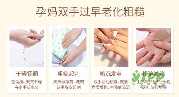 孕妇秋冬季节可以用护手霜吗 什么品牌护手霜最适合孕妇