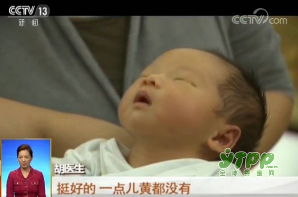 惊心动魄的分娩：胎儿濒死危急关头医生做了这个决定 太揪心了