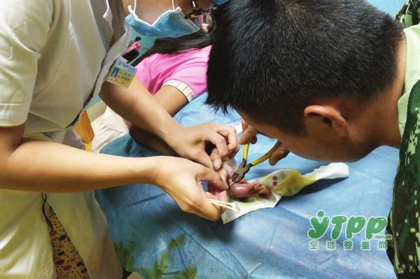 贵州铜仁一女孩戒指卡手3个月 中指腐烂能见骨