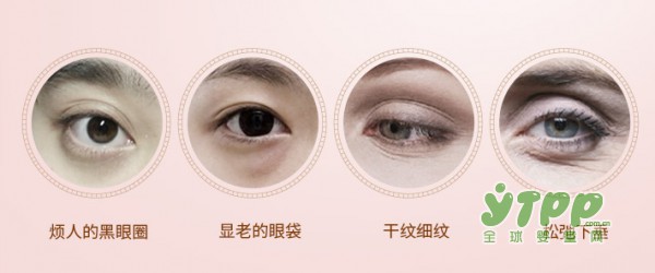 孕期眼霜用得好 孕妈年轻十岁不显老