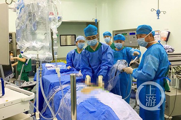 四川宜宾一位9岁男童双肾长了9颗结石  诱因可能是婴儿时期喝的奶粉造成