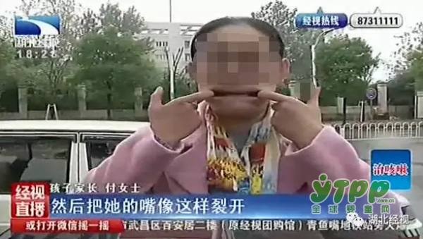 幼儿身上多处淤青 孩子在幼儿园又受委屈了