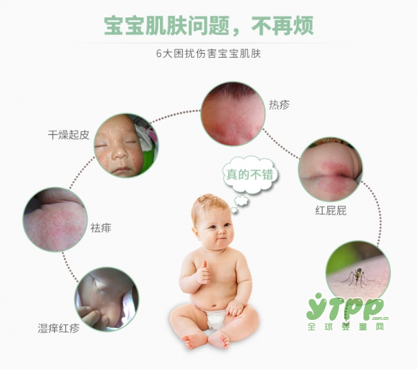宝宝湿疹睡不安稳怎么办 宝妈们别烦恼婴草霜呵护宝宝肌肤健康