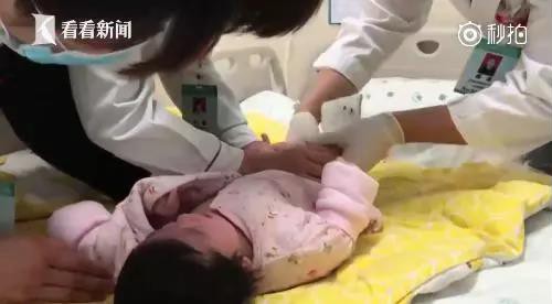 2个月大宝宝险被截肢  原因竟是一根头发丝  护理宝宝时要注意啦