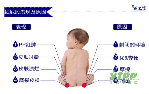 戒之馆婴臀膏  专为宝宝红屁股而生  妈妈安心的选择