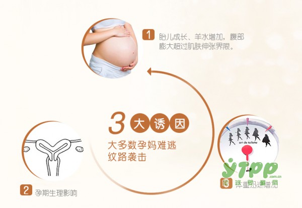 孕妈妈越孕越美的秘密是什么  袋鼠妈妈孕妇橄榄油让你的孕期纹丝不动