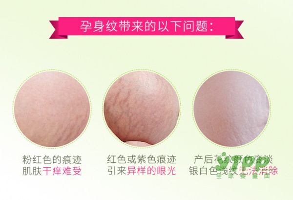 准妈妈在怀孕期为什么要使用橄榄油？