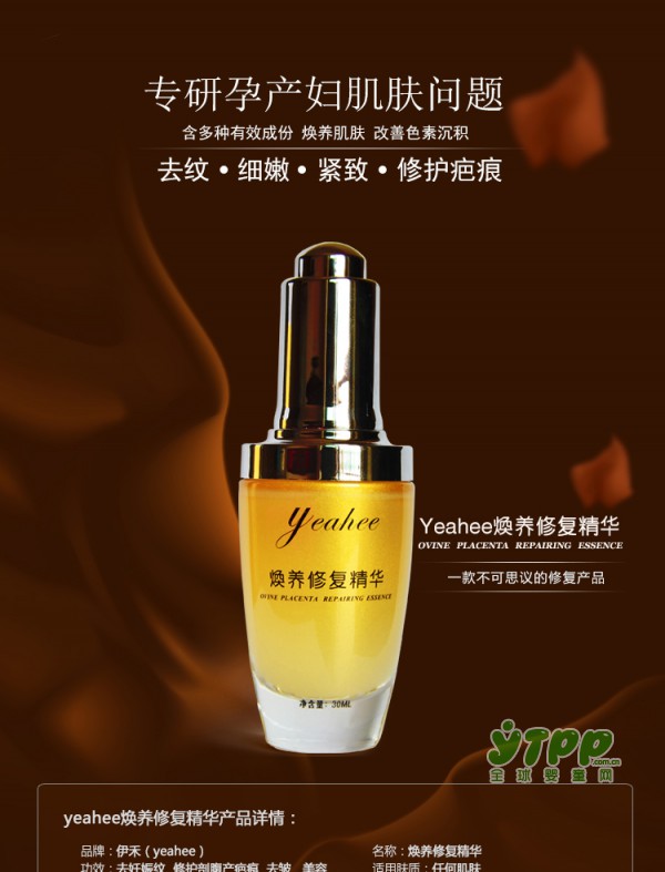 你知道什么是产后综合症吗？