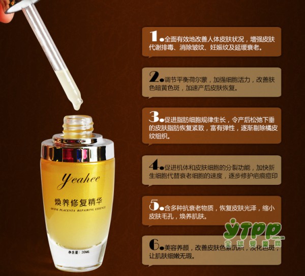 你知道什么是产后综合症吗？