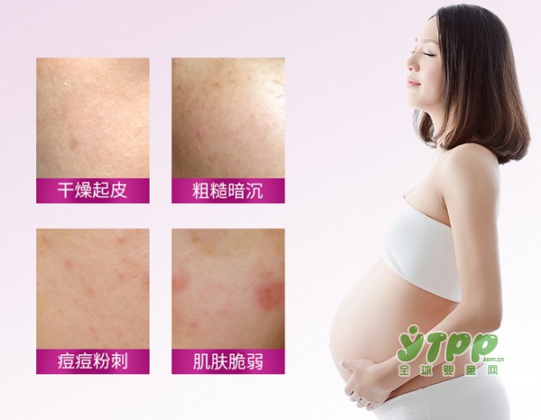 每位孕美人的大敌：肌肤缺水