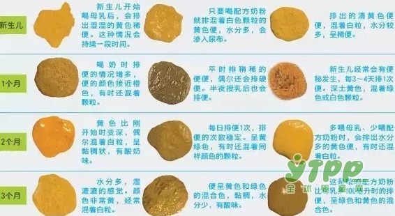 宝宝大便除了会发绿，还会发红发白？