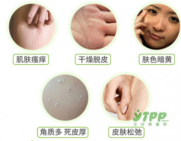 秋季来啦 孕期的肌肤你护理好了吗