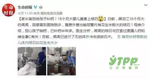 18个月大的宝宝患有结石 竟是钙没补对  葵花童博士教你怎么给宝宝补钙