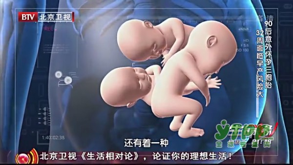 怀多胎的孕妈妈要了解：什么是单卵双绒三羊  有哪些危险