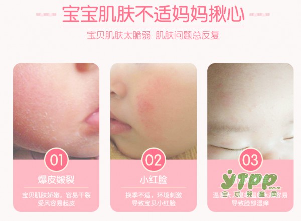 宝宝们用什么护肤品比较好 郁美净儿童霜秋冬季节宝宝必备品。