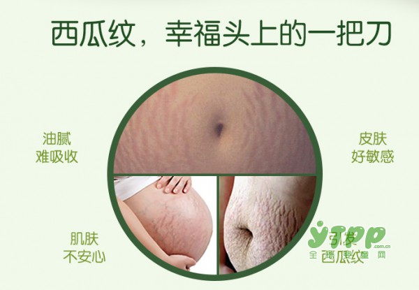 怎么才能消除妊娠纹 为什么孕期会出现妊娠纹