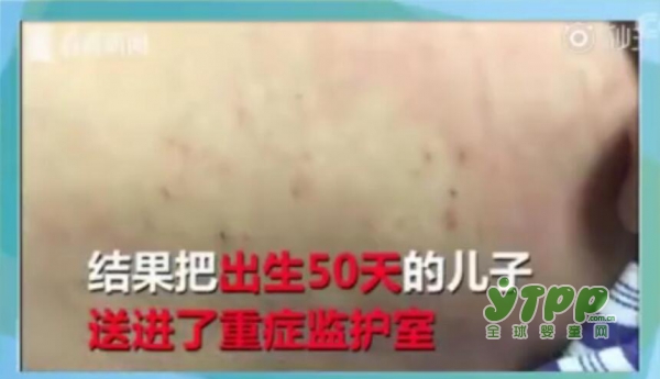 湖北50天大的宝宝因闹夜被扎40针    新生儿会出现哪些睡眠问题