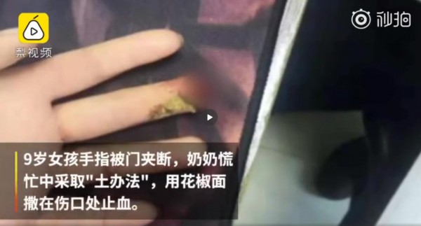 #用花椒面止血感染截肢#   不靠谱的“土方法”要警惕