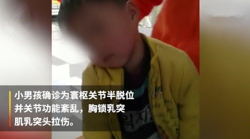 躺着玩手机太久, 男童变“歪头宝宝”