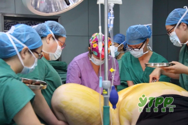 孕期体重超标会有哪些危险  孕妈妈补充营养要慎重啦