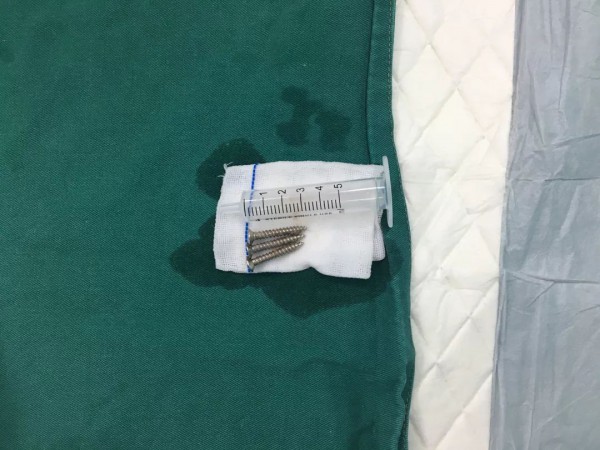 三岁大宝给小宝喂了3颗钉子 在家照顾孩子时应该注意什么