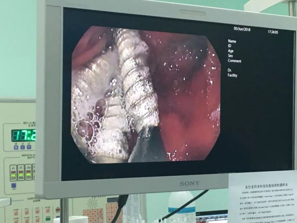 三岁大宝给小宝喂了3颗钉子 在家照顾孩子时应该注意什么