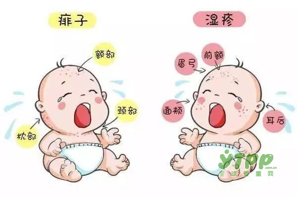 夏天宝宝身上长痱子怎么办 推荐贝优杰宝宝清凉玉米热痱粉