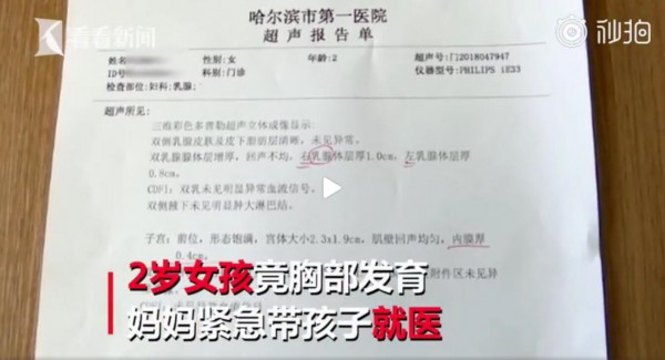 黑龙江一名2岁女孩胸部发育达到10岁水平    如何预防孩子性早熟