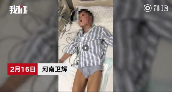 #官方回应男孩被狗舔伤口死亡#   如何预防狂犬病