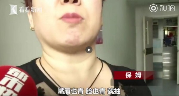 什么是热性惊厥   宝宝发生热性惊厥如何紧急处理好