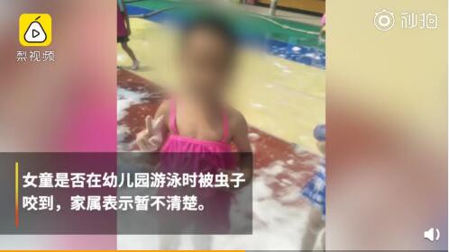 夏季游泳要注意：女童疑似游泳时被虫叮咬离世 医生：恙虫病