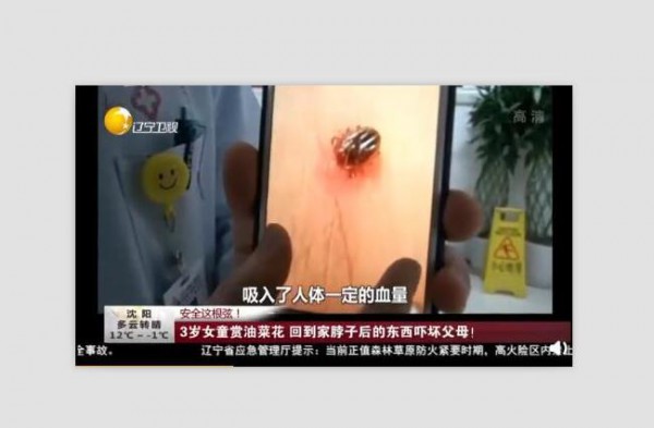 3岁女童赏油菜花 回家后脖子上长出一个蜱虫
