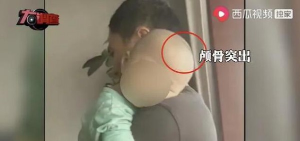 固体饮料=奶粉？“大头娃娃”再现   为了销量不择手段  该谁来买单？