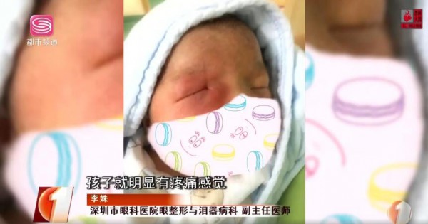 深圳4个月大婴儿眼角抽出5管脓液 宝宝泪眼汪汪竟是病……