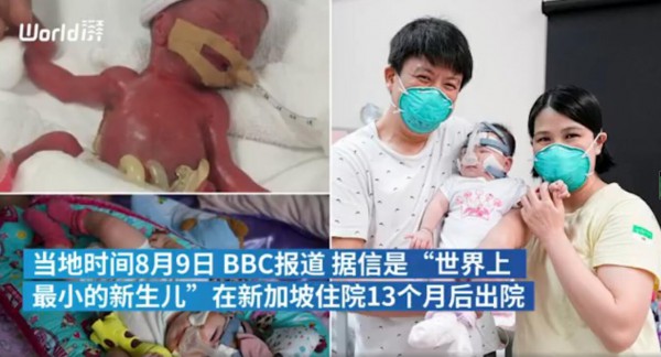 世界最小新生儿仅苹果重  新生儿体重低怎么办  低体重儿如何喂养长的更快