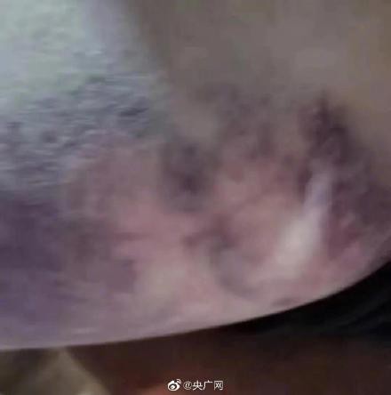 河北多名孩子在夏令营被暴力殴打写纸条求救   家长要如何选择适合孩子的夏令营