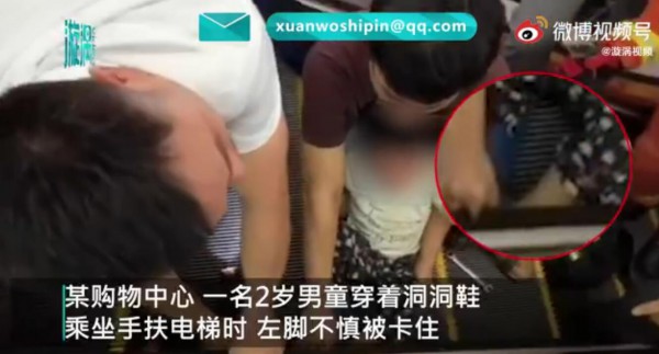 2岁男童穿洞洞鞋脚卡进手扶电梯    儿童穿洞洞鞋哪些危害