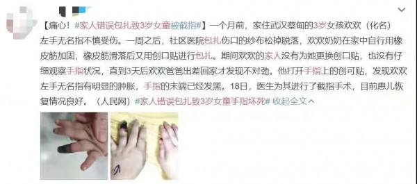家人错误包扎致3岁女童被截指  这些宝宝受伤的正确处理方法 家长一定要学会