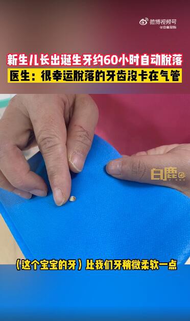 宝宝出生就有牙齿60小时后又自动脱落 如何处理早生齿