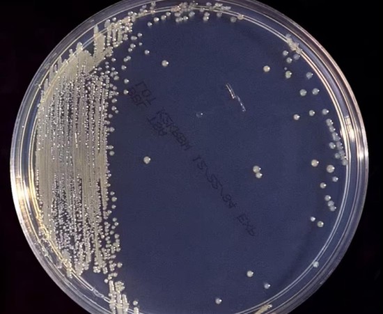 雅培奶粉致美国2名婴儿死亡案调查结果出炉  生产线存在卫生安全问题