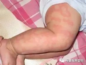 这些东西不能喂给宝宝吃，会后悔莫及
