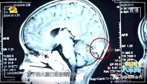 这些东西不能喂给宝宝吃，会后悔莫及