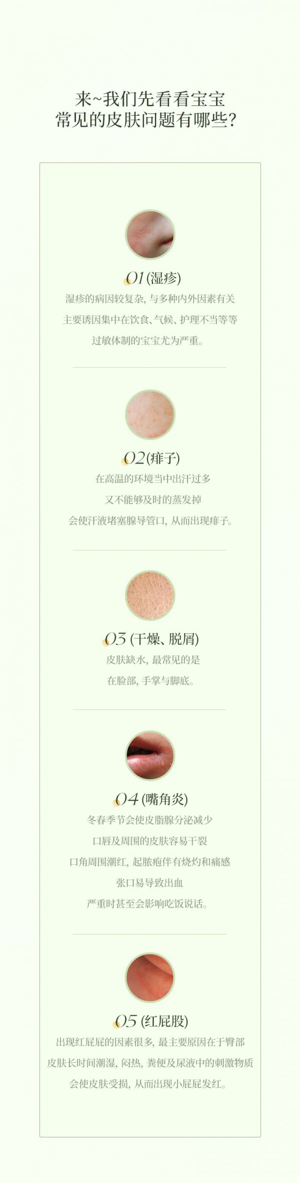 菲丽洁 | 夏天宝宝常见的问题高发期有哪些？如何对症下药？