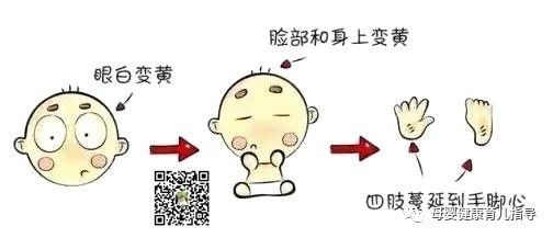 新生儿黄疸，你了解多少？