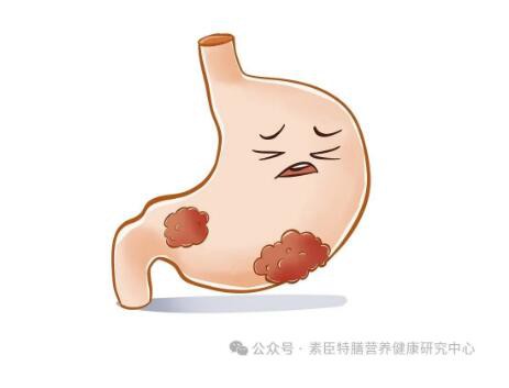 复合消化酶：拯救宝宝积食、消化不良